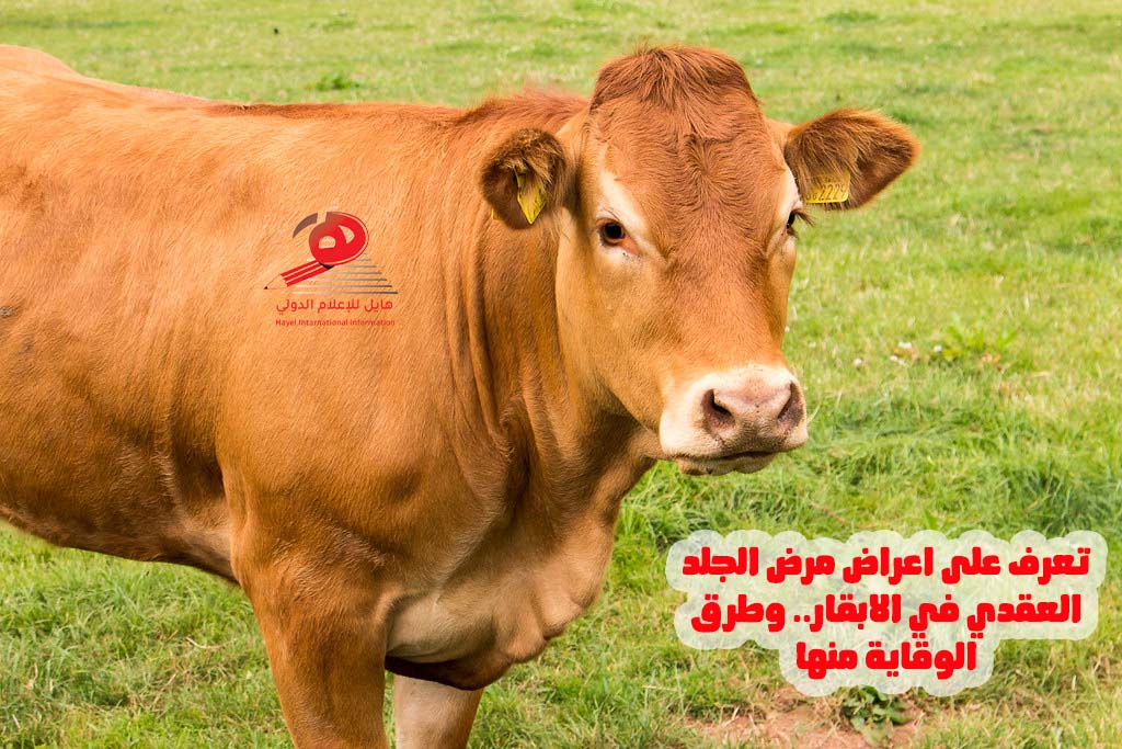 تعرف على اعراض مرض الجلد العقدي في الابقار.. وطرق الوقاية منها تعرف على اعراض مرض الجلد العقدي في الابقار.. وطرق الوقاية منها